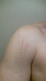 shoulder.jpg