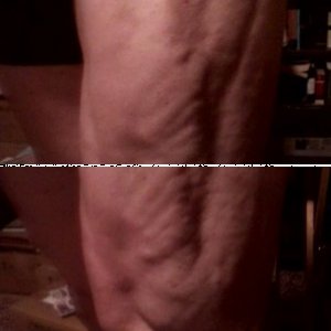 Quad striations