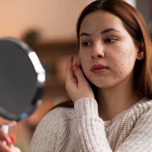 Media 'Как убрать отеки под глазами' in album 'images'