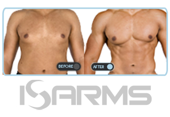 sarms-strength gain