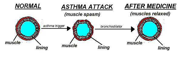 bronchodilator